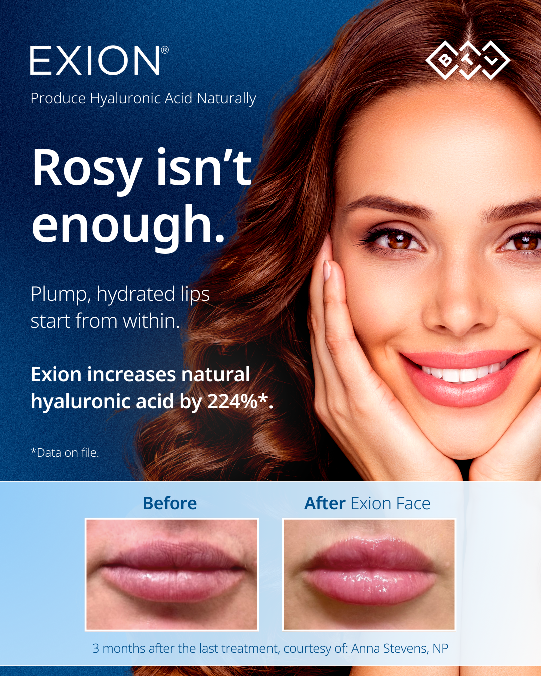 Exion POST September Calendar Part 4 ENUS100 IGFB1 - EXION™ in Louisville, KY